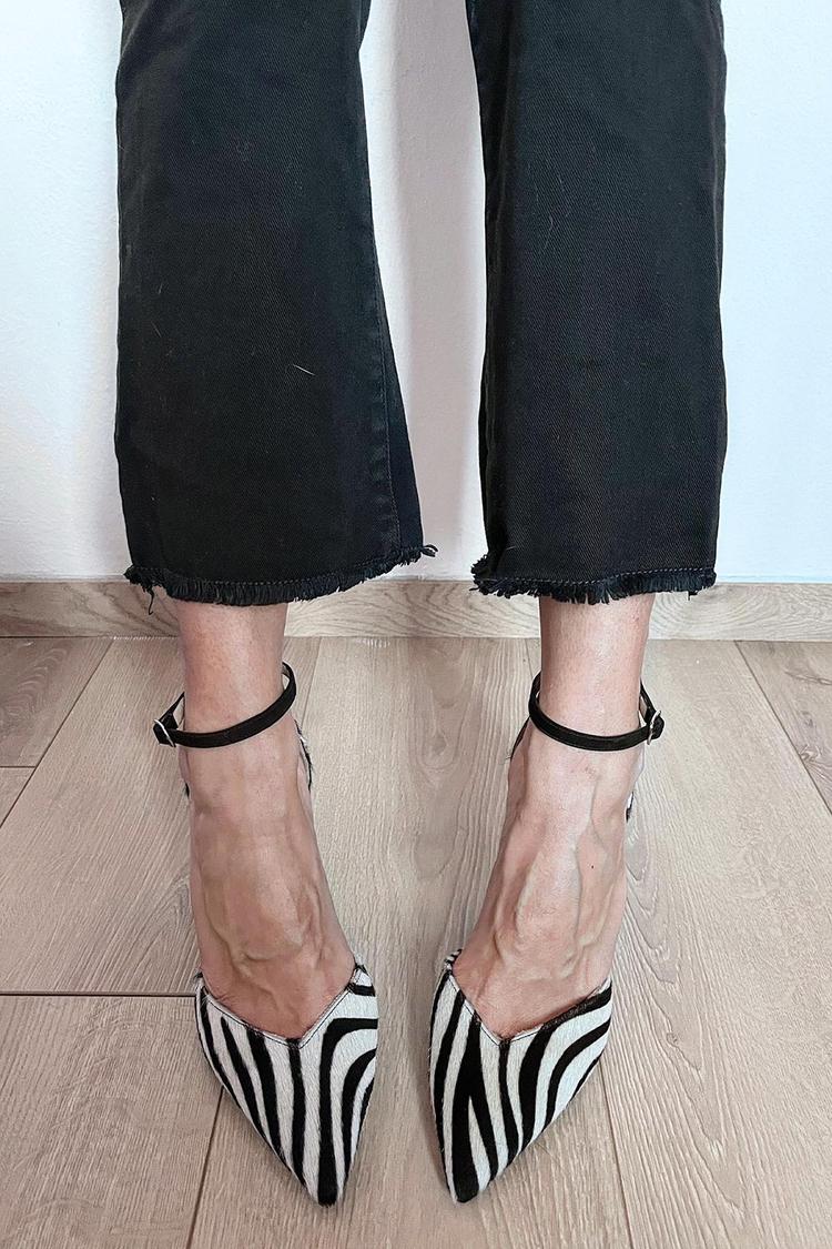 Zebra Print Pumps – Elegant Ankle Strap